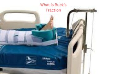 Buck’s Traction
