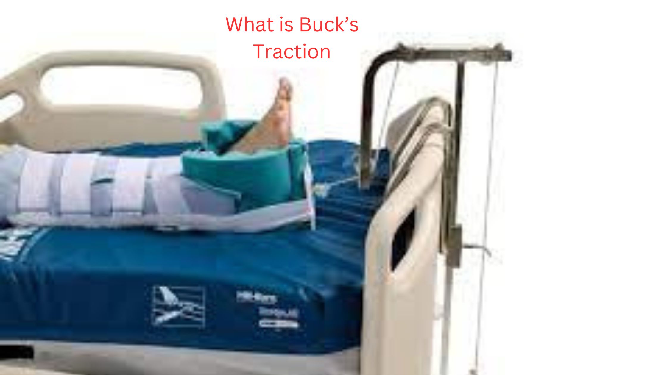 Buck’s Traction